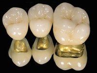 Медуниверситет заплатит 500 руб морального вреда по стоматологическому иску