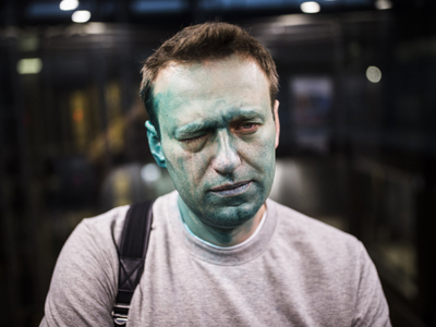 МВД возбудило уголовное дело после нападения на Навального